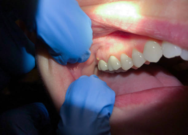 Best Walk-In Emergency Dentist in Inverness Highlands South, FL